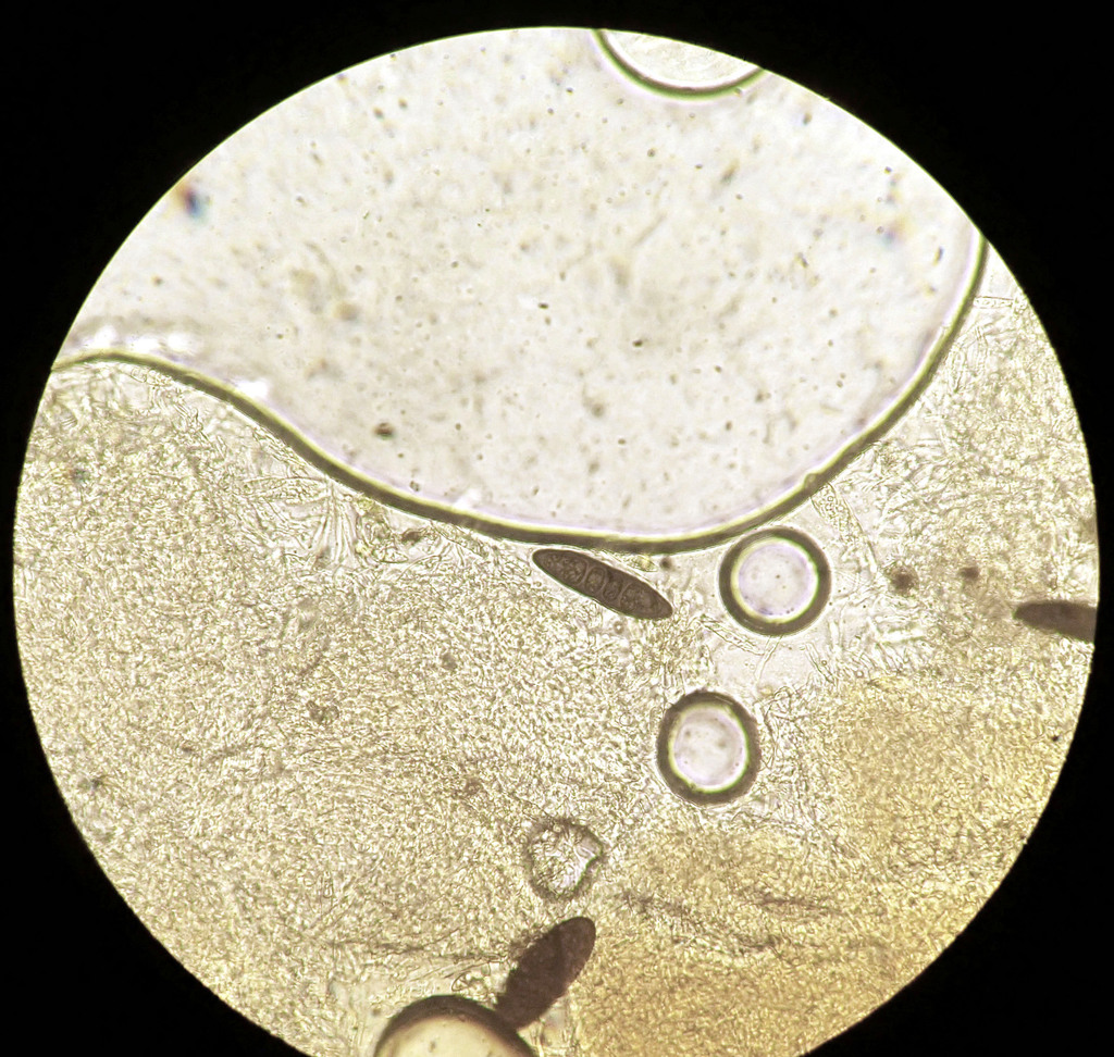 Massaria vomitoria