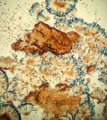 Sclerococcum stygium