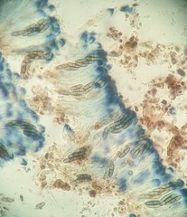 Sclerococcum stygium