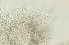 Xylariaceae