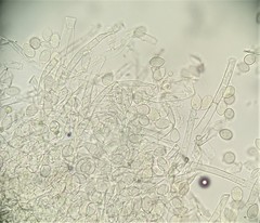 Botryobasidium
