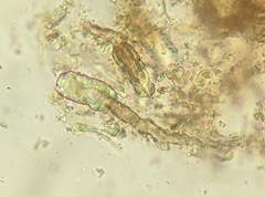 Peniophora