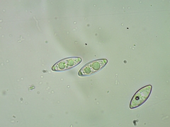 Byssonectria terrestris