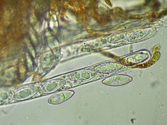 Byssonectria terrestris