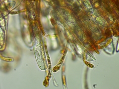 Byssonectria terrestris