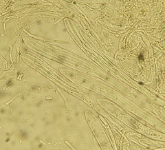 Parachnopeziza miniopsis