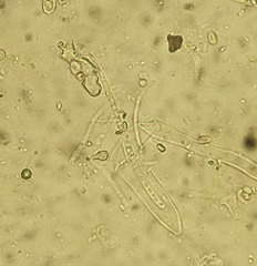 Parachnopeziza miniopsis