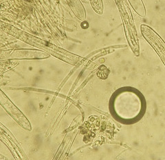 Parachnopeziza miniopsis