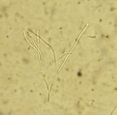 Parachnopeziza miniopsis