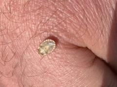 Sciocoris sideritidis