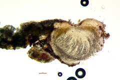 Gyalecta herrei