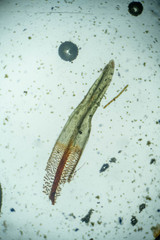 Encalypta rhaptocarpa