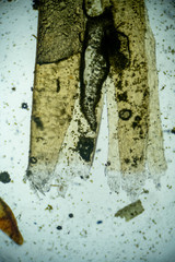 Encalypta rhaptocarpa