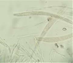 Rhytismataceae