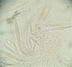 Rhytismataceae