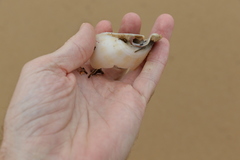 Phalium bandatum