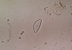 Cymbella