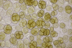 Urocystis syncocca
