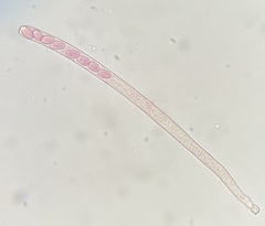 Peziza varia
