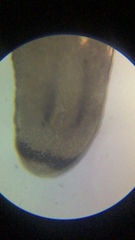 Macrostomum
