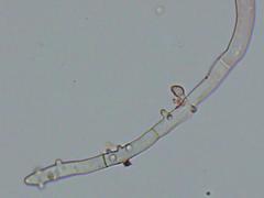 Botryobasidium conspersum