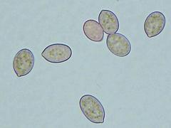 Botryobasidium conspersum