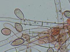 Botryobasidium conspersum