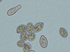 Botryobasidium conspersum