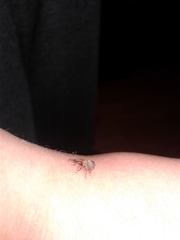 Anthonomus quadrigibbus