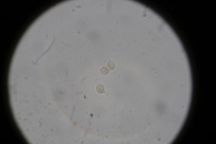 Rhodocybe lateritia