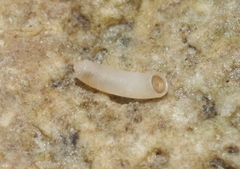 Caecum