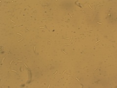 Myriosclerotinia curreyana
