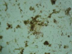 Anthophysa