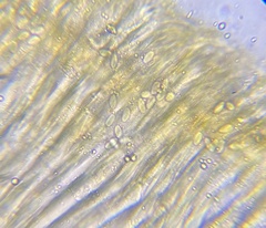 Elaiopezia waltersii