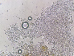 Bacidia crenulata