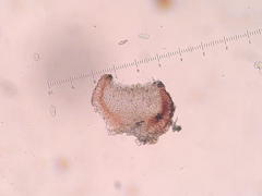 Bacidia crenulata