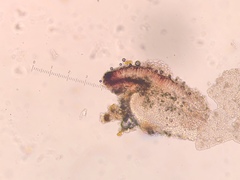 Bacidia crenulata