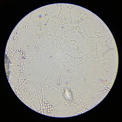 Phialemonium inflatum