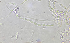 Phialemonium inflatum