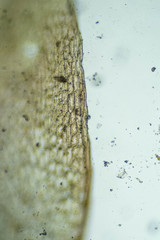 Ptychostomum cryophilum