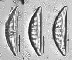Amphora copulata