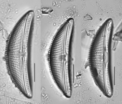 Amphora ovalis