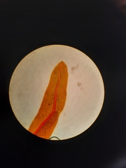 Fissidens asplenioides