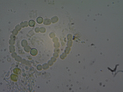 Dolichospermum