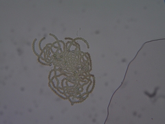 Dolichospermum