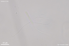 Pycnopeziza sympodialis