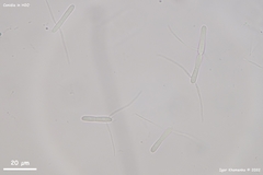 Pycnopeziza sympodialis