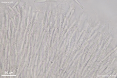 Pycnopeziza sympodialis