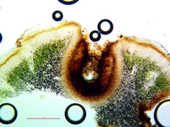 Placidium squamulosum