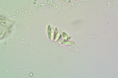 Placidium squamulosum